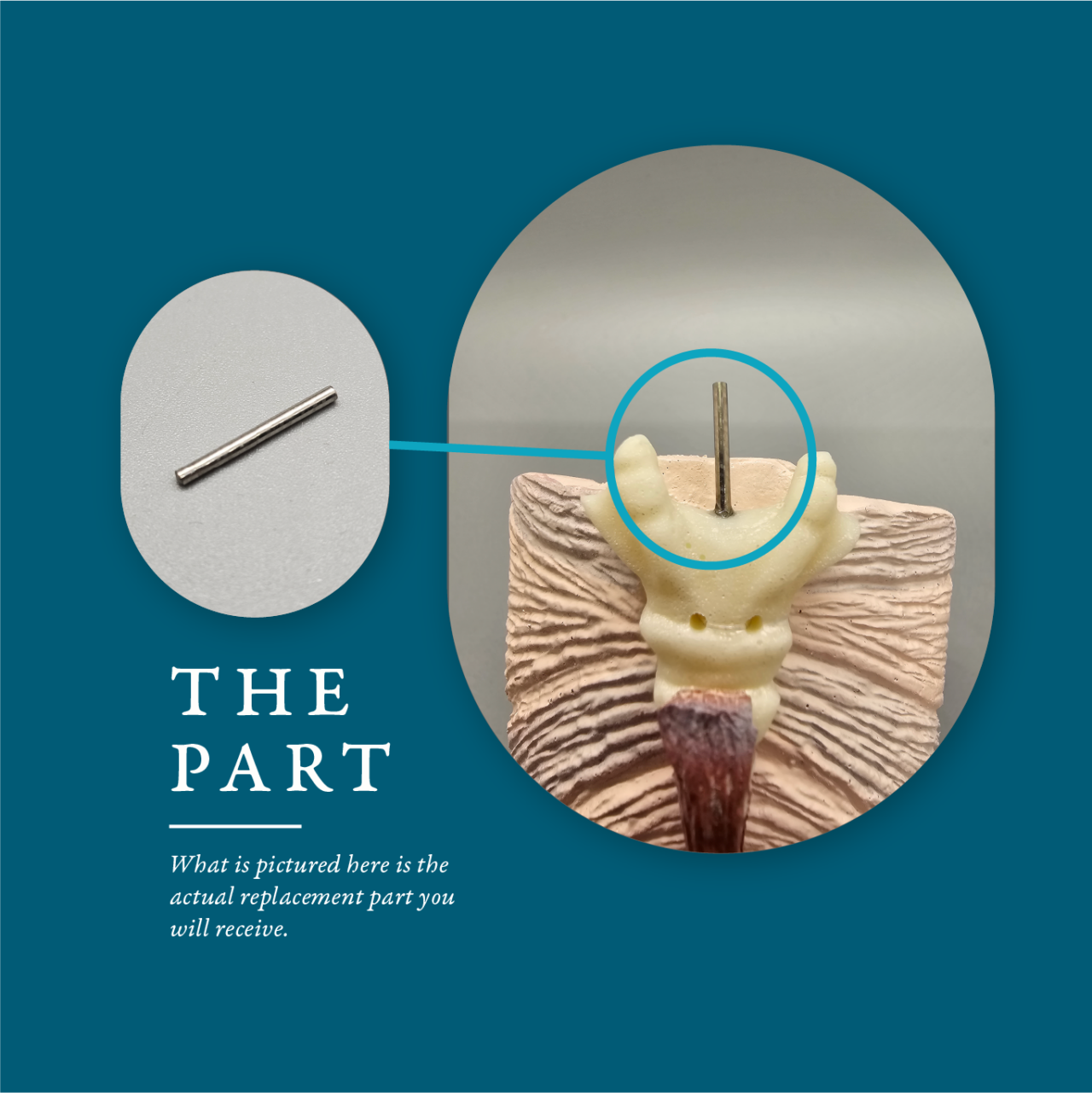 Dowel Pin Replacements for ESP Models CMT Medical